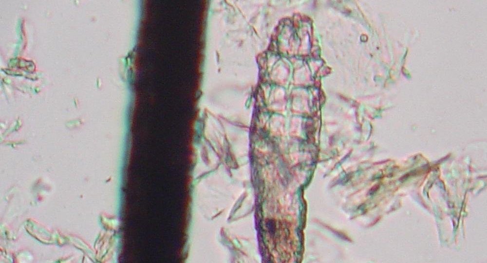 SALUD / MILES DE PARÁSITOS QUE SOLO SE PUEDEN VER A TRAVÉS DE UN MICROSCOPIO HABITAN EN NUESTRA CARA