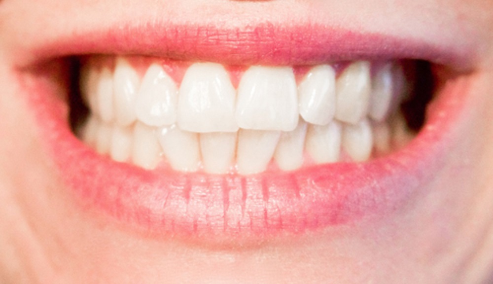 CIENCIA / ¿ADIÓS CARIES?: INVESTIGADORES DEL «CSIC» DE ESPAÑA DESARROLLAN NANOPARTÍCULAS PARA REMINERALIZAR DIENTES Y HUESOS