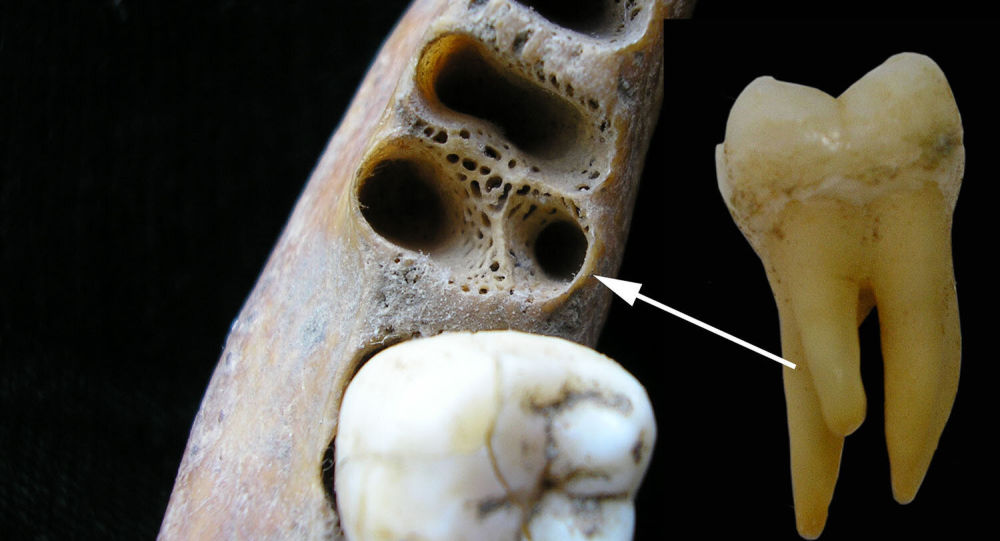  Los molares antiguos apuntan al cruce entre Humanos Arcaicos y Homo Sapiens en Asia