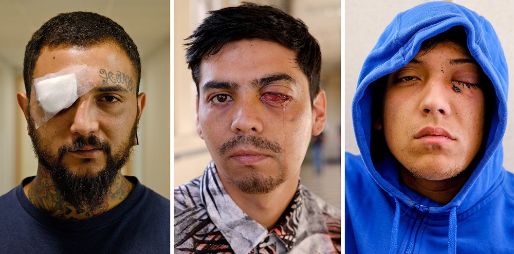 Documental de The New York Times sobre traumas oculares ocasionados por Carabineros ganó primer lugar en World Press Photo 2020 | Video