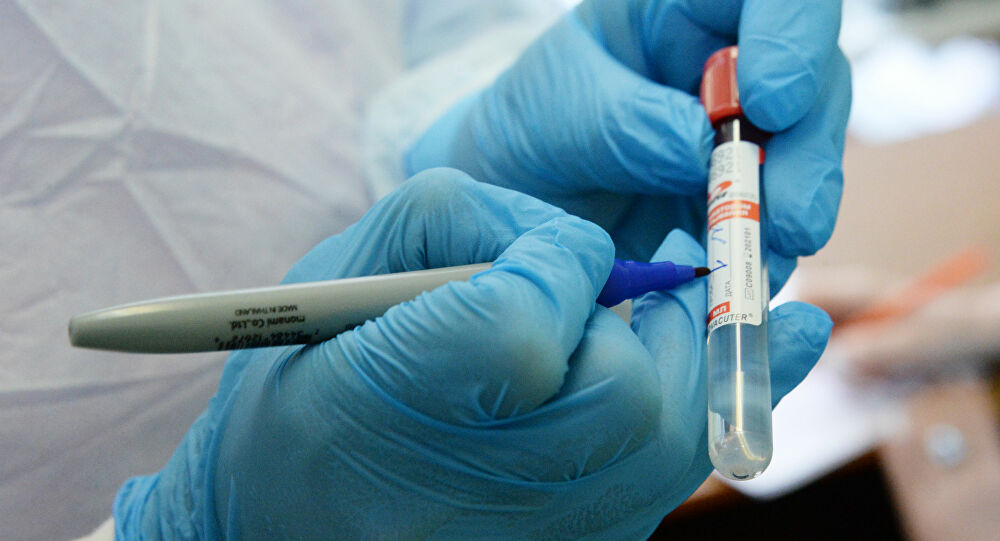  Bolivia admite escasez de pruebas de coronavirus: solo 3.923 en más de dos meses