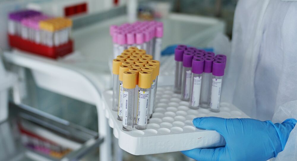 Moscú, primera ciudad del mundo en ofrecer test de anticuerpos del COVID-19 masivamente y gratis