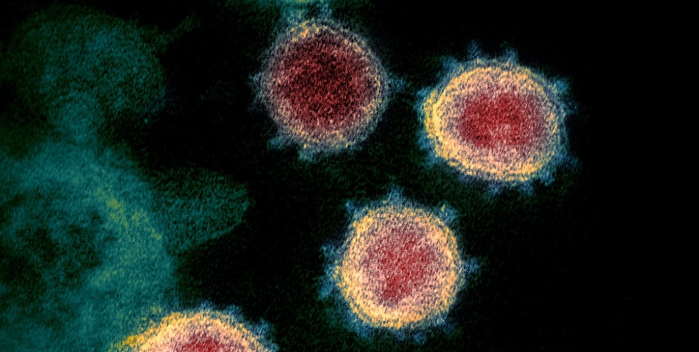  ¿Un coronavirus causó la pandemia que mató al heredero de la reina Victoria?