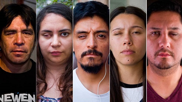 Exigieron que Minsal aclare situación de plan de atención a víctimas oculares