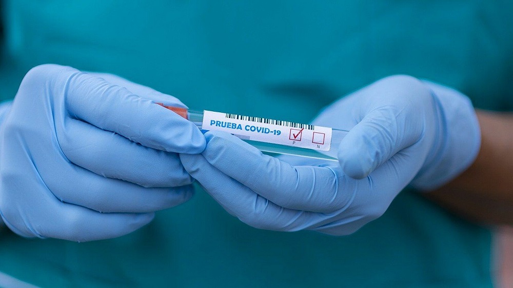  El misterio de 171 pacientes en EEUU que reaviva las dudas sobre el origen del coronavirus