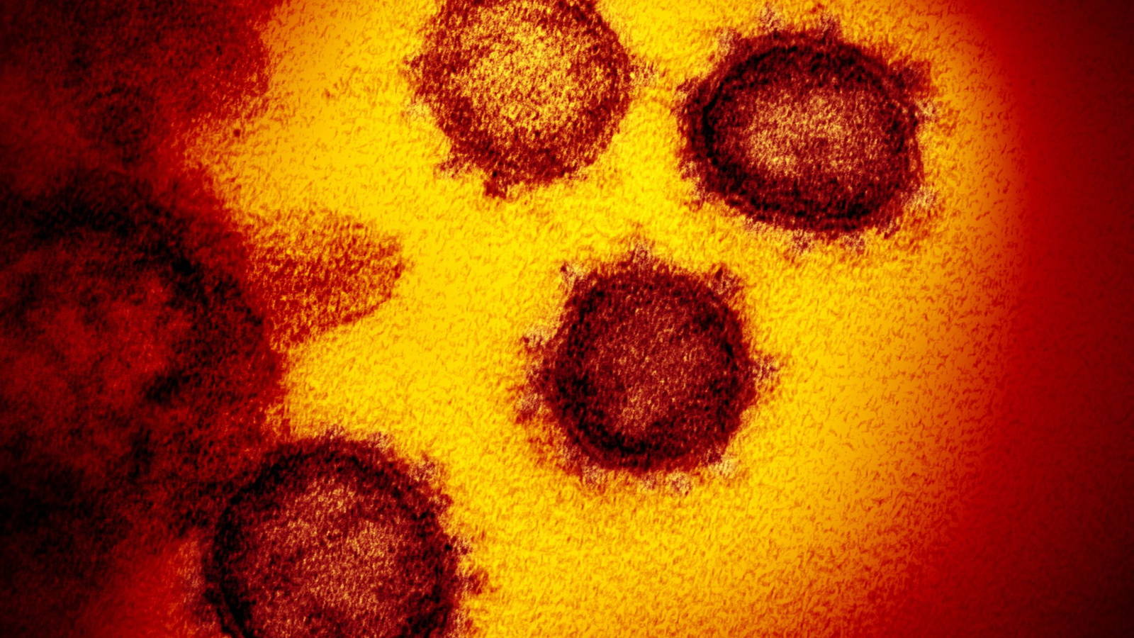  La inteligencia estadounidense publica un informe sobre el origen del coronavirus
