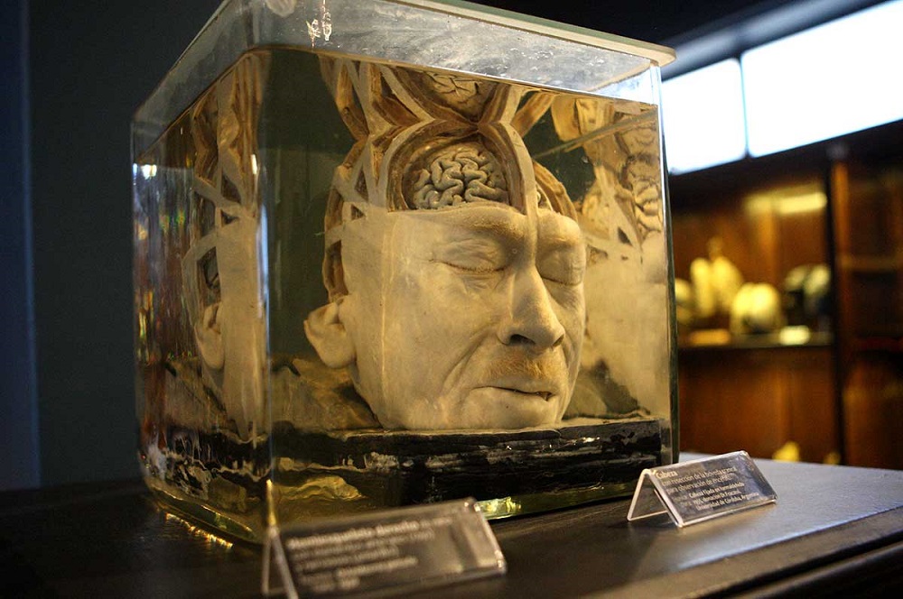 Museo de Anatomía celebra sus 100 años de vida