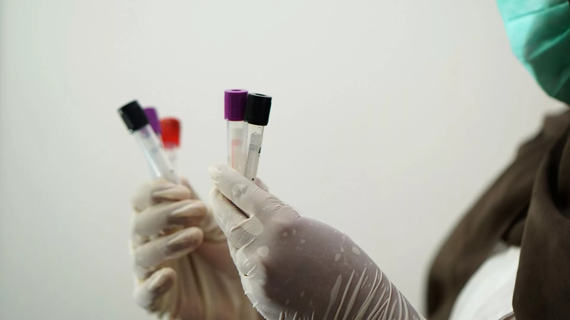 EEUU admite haber ayudado a mantener 46 laboratorios biológicos en Ucrania en las últimas 2 décadas